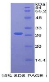 SDS-PAGE (FRS2-22H).jpg